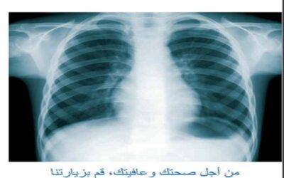 Tríptico Programa de Prevención de Tuberculosis (árabe)