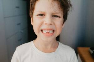 Qué hacer ante un traumatismo dental: Salvando tu diente tras un golpe